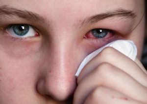 Gây stress, mệt mỏi